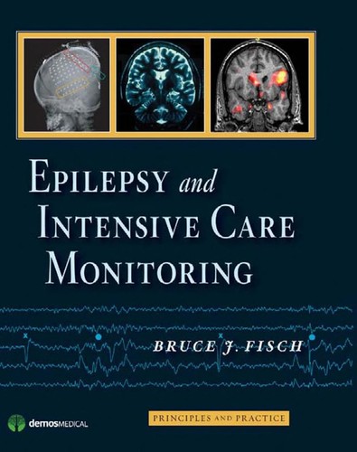 Epilepsy and Intensive Care Monitoring: Principles and Practice — Bruce Fisch, MD (2009)