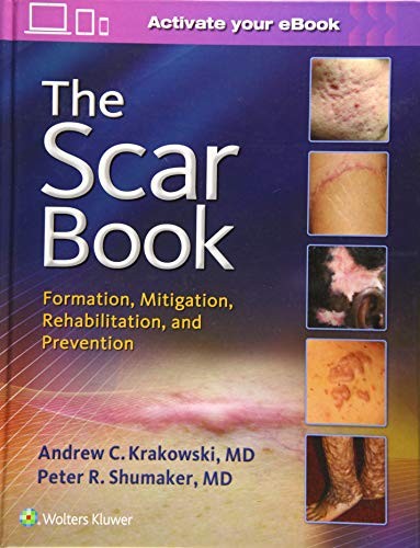 The Scar Book: Formation, Mitigation, Rehabilitation, and Prevention — Andrew C. Krakowski et al. (2017)