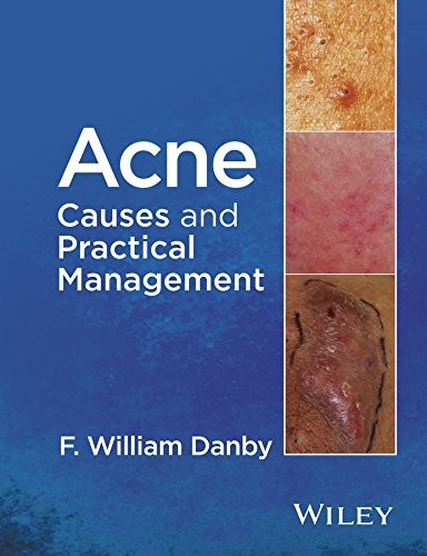 Acne: Causes and Practical Management — F. William Danby (2015)