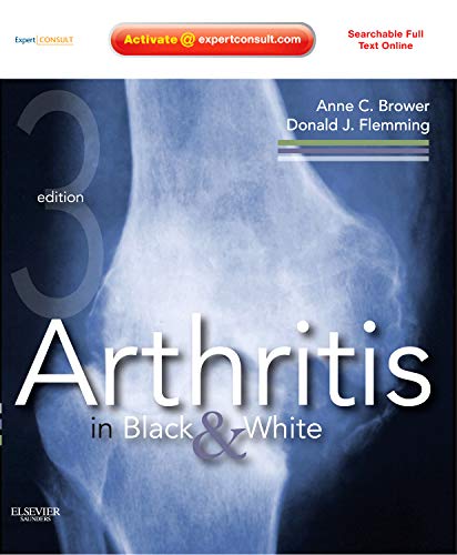Arthritis in Black and White — Anne C. Brower et al. (2012)