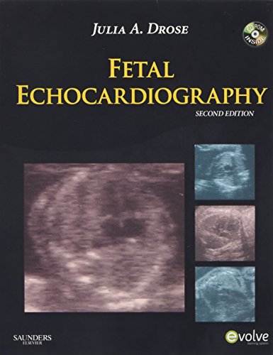 Fetal Echocardiography — Julia A. Drose (2010)