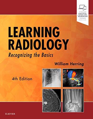 Learning Radiology: Recognizing the Basics — William Herring (2019)
