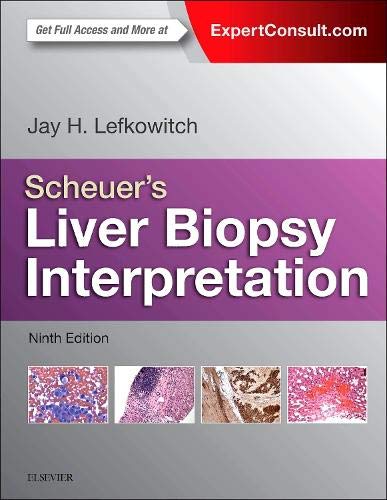Scheuer's Liver Biopsy Interpretation — Jay H. Lefkowitch, MD (2015)