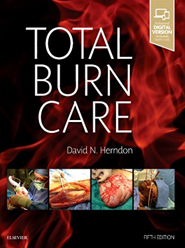 Total Burn Care — David N. Herndon (2017)